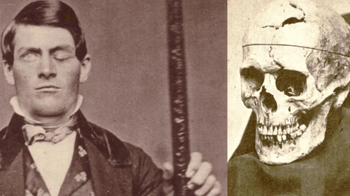 Phineas Gage: un viaje fascinante a través de la neurociencia y la resiliencia humana.