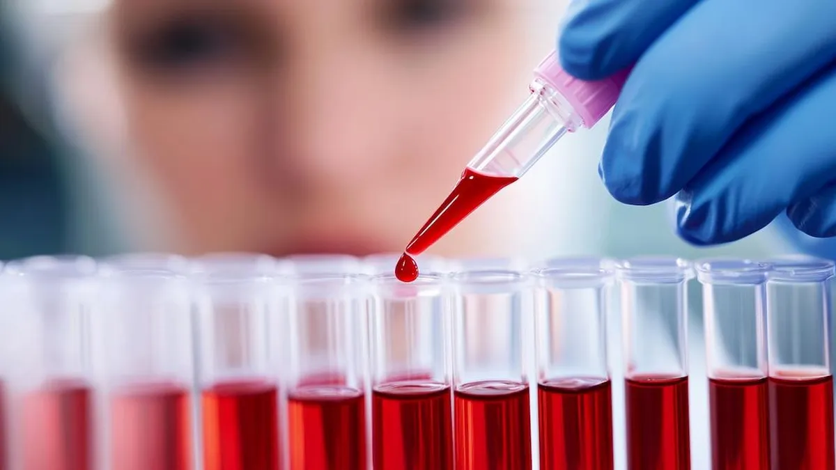 Los síntomas ocultos de la deficiencia de hierro que podrían sorprenderte