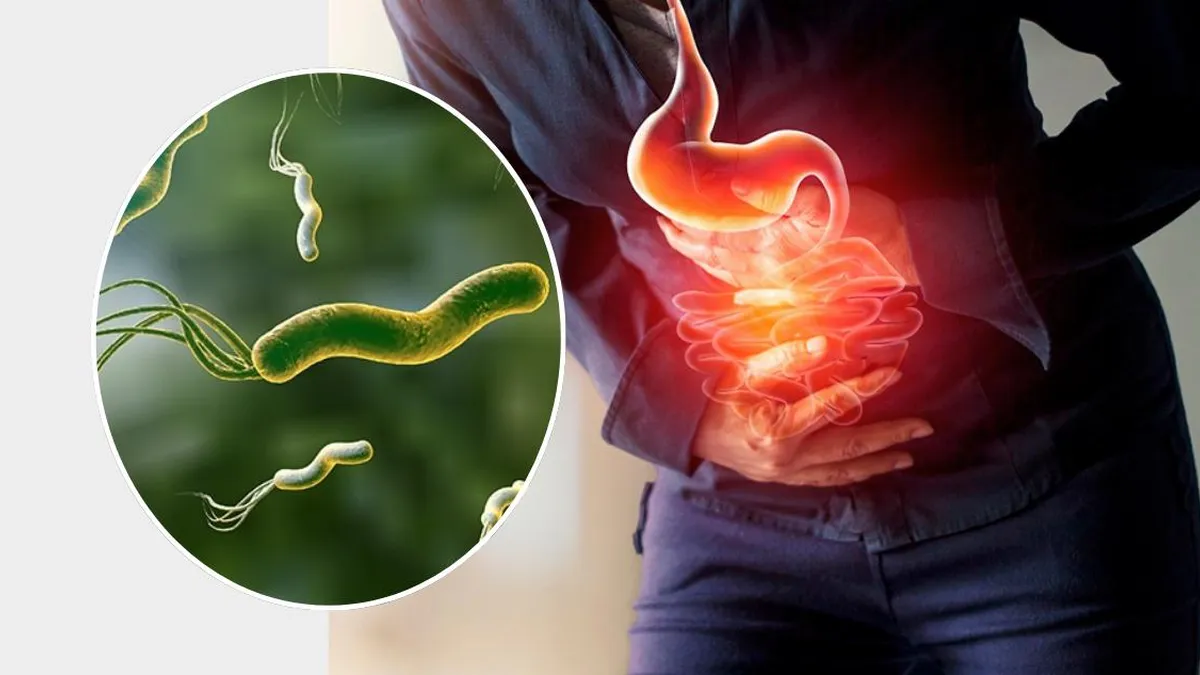 Bacteria que afecta al 70% de la población y está relacionada con el cáncer.