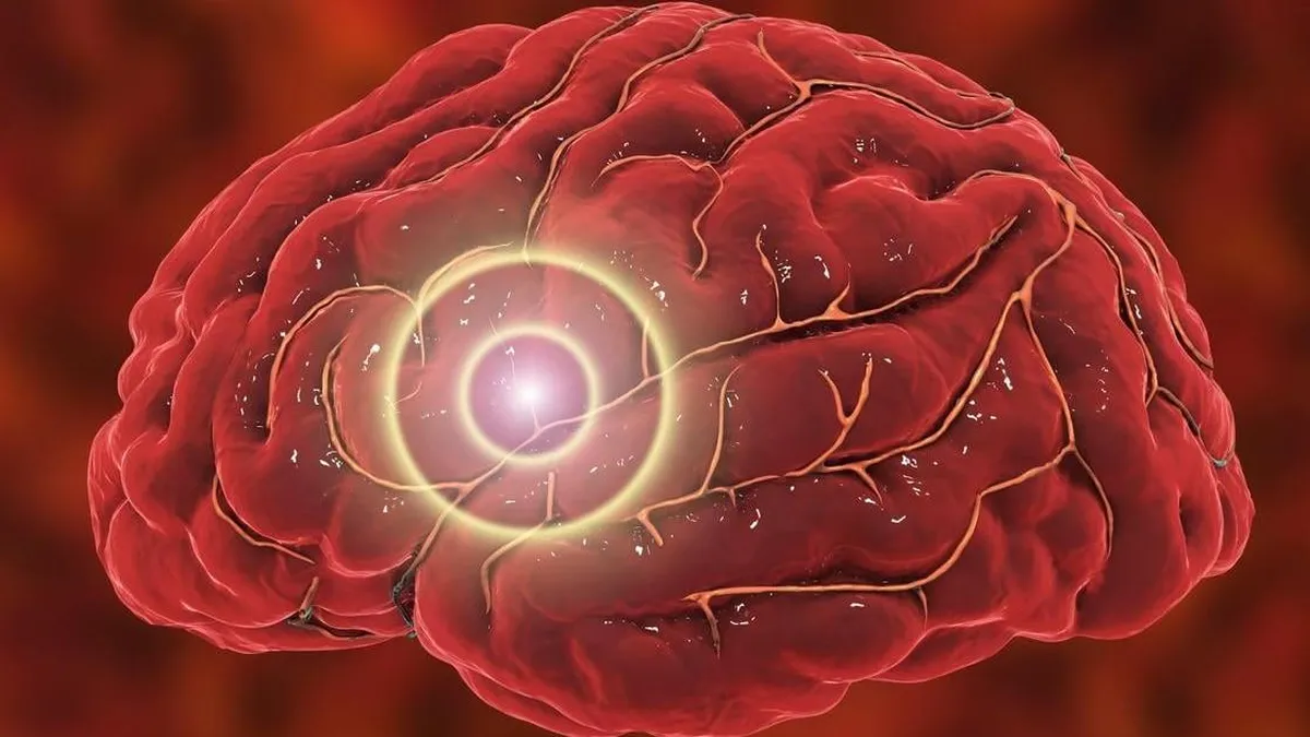 Estimulación cerebral en casa: una nueva esperanza para tratar la depresión