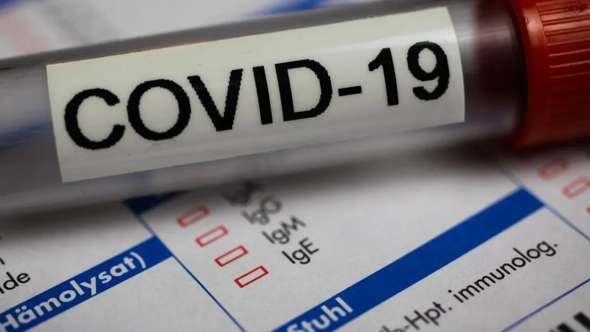 Aumento del riesgo cardíaco en casos graves de COVID y antecedentes de enfermedades.