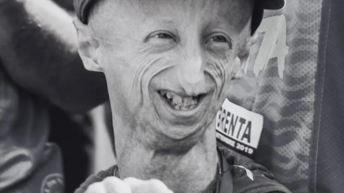 Fallece Sammy Basso, el científico que luchó contra la progeria y dejó un legado inspirador