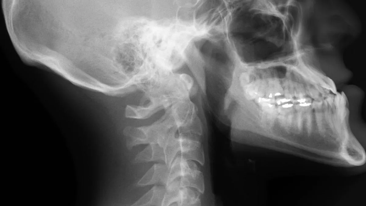 Descubren los Obeliscos, nuevos agentes infecciosos que desafían nuestra comprensión biológica