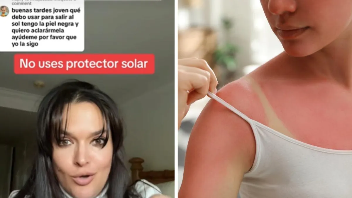 Dermatóloga alerta: la peligrosa moda de no usar protector solar puede costarte la salud
