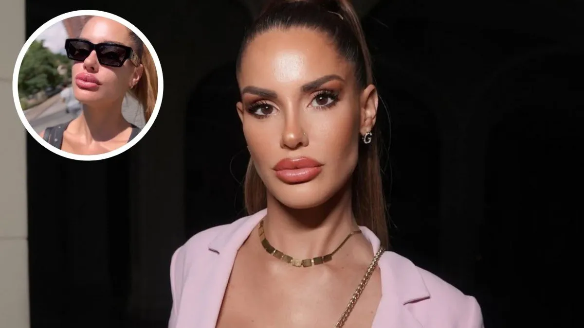 Gala Caldirola revela el sorprendente motivo detrás de su cambio estético en los labios