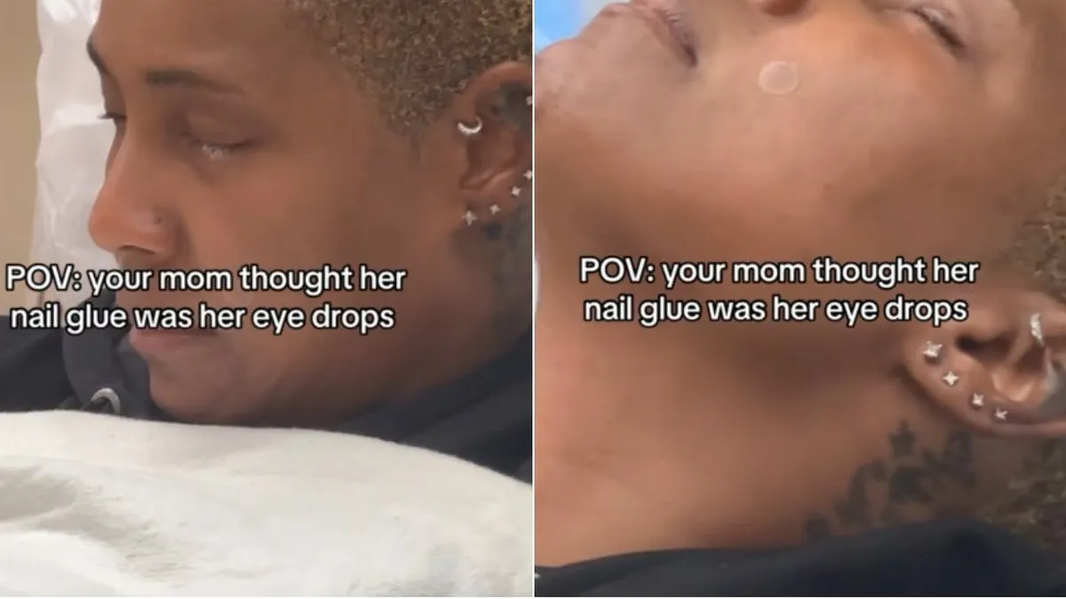 Mujer confunde gotas para los ojos con pegamento y sufre un grave accidente ocular.