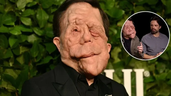 Adam Pearson: un valiente que redefine la belleza y enfrenta su lucha con coraje.