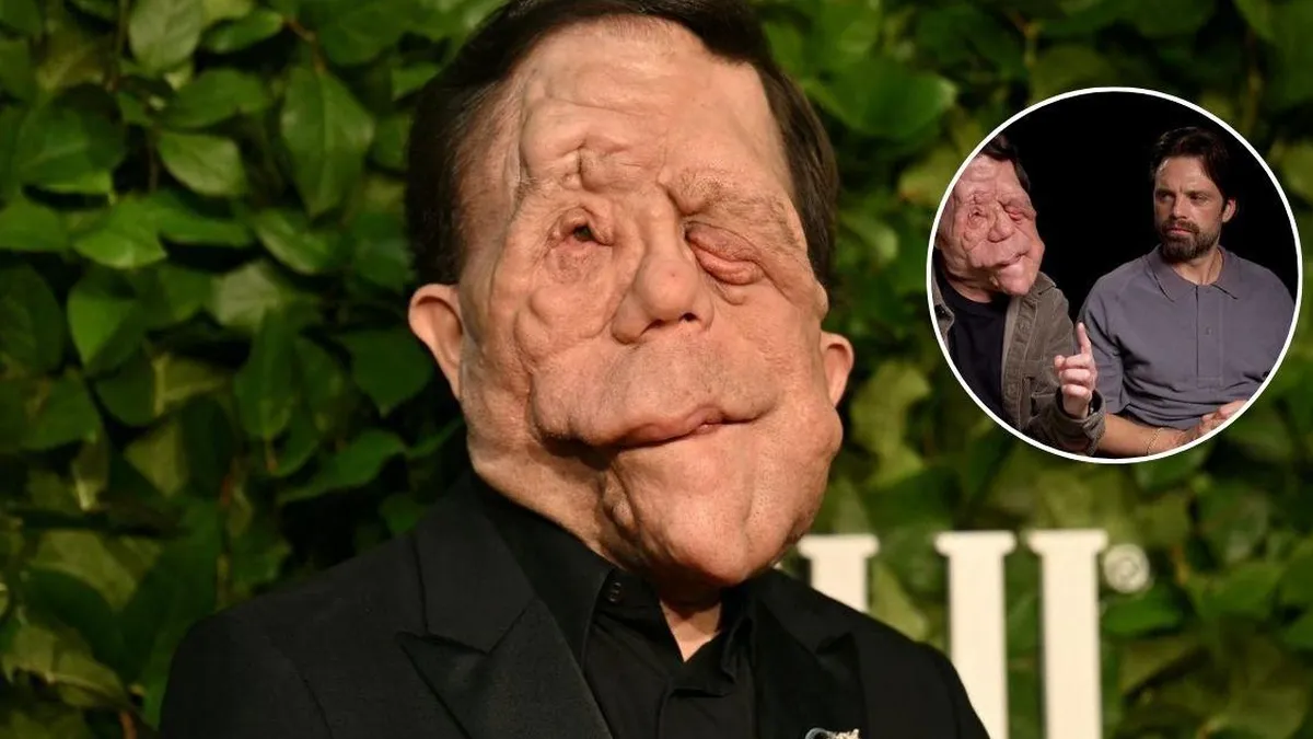 Adam Pearson: el actor que desafía estereotipos y brilla en Hollywood a pesar de su condición