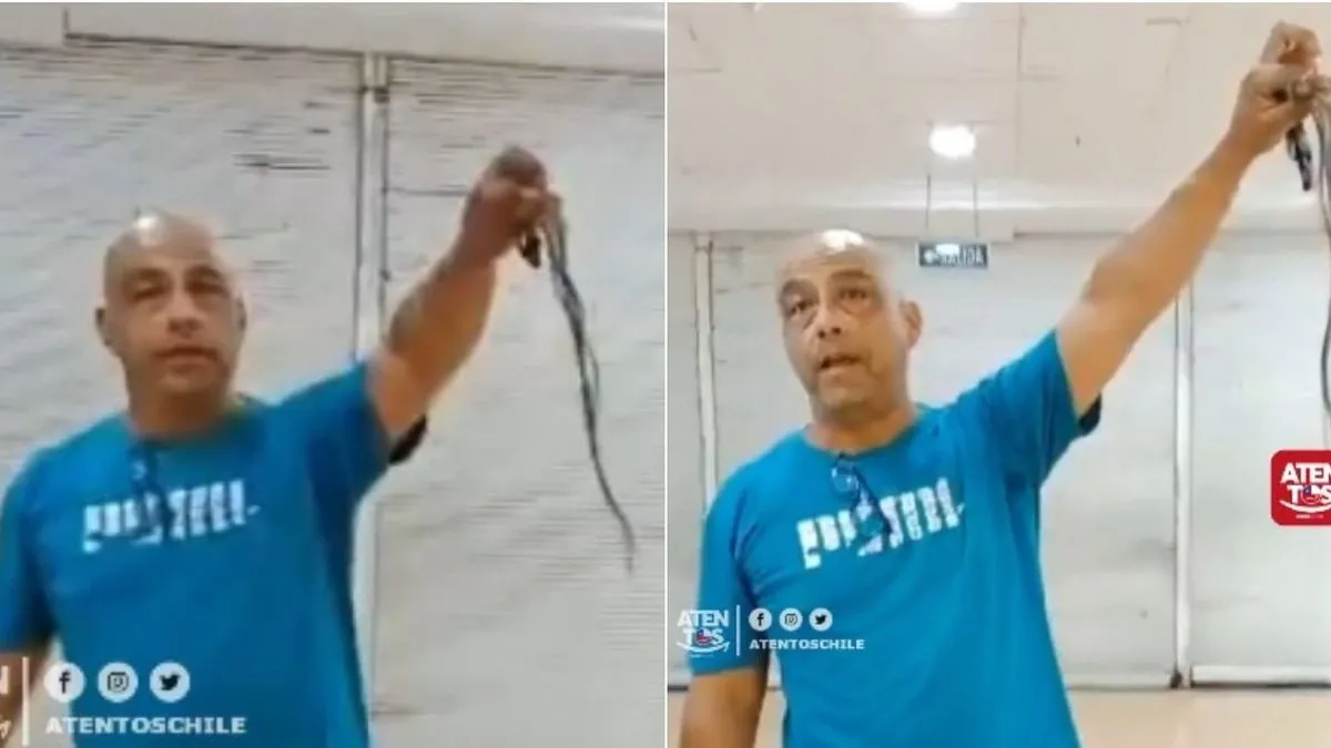 Padre denuncia grave quemadura en su hija tras visita a peluquería en Quilpué y pide ayuda en redes sociales