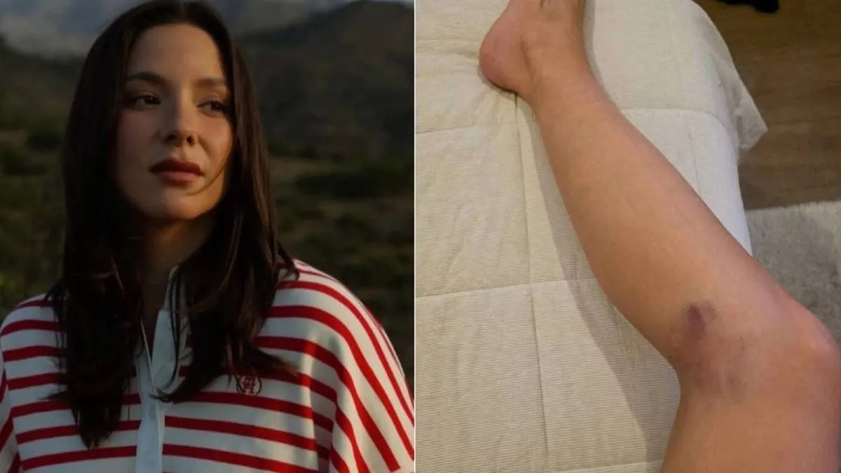 Kel Calderón revela accidente ecuestre y reflexiona sobre el “karma” tras burlarse de su pareja