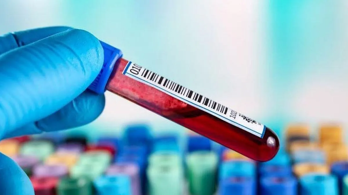 Nuevo análisis de sangre promete diagnosticar y rastrear el Alzheimer con precisión.